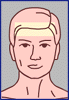 hair line