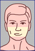 membranas mucosas (oral, nasal)